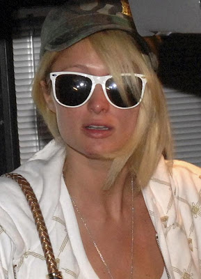 Paris Hilton paparazzi injury