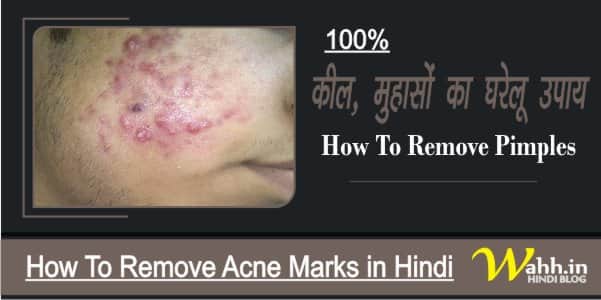 How-To-Remove-Pimples-in-Hindi-At-Home