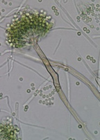 fruiting body of Aspergillus