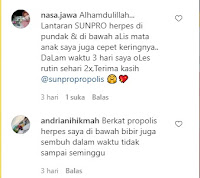 herbal untuk herpes