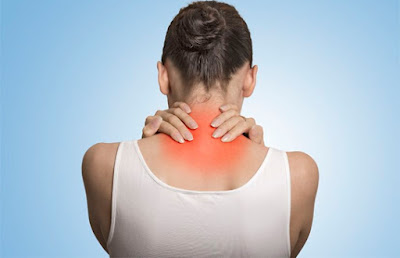 Nguyên nhân đau dây thần kinh cổ gáy là gì ?