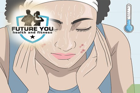what worked for my acne was the drug-free way (part 1)