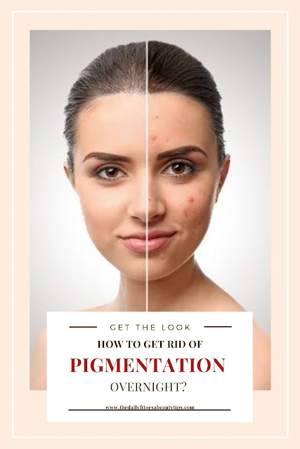skin-pigmentation-remedy