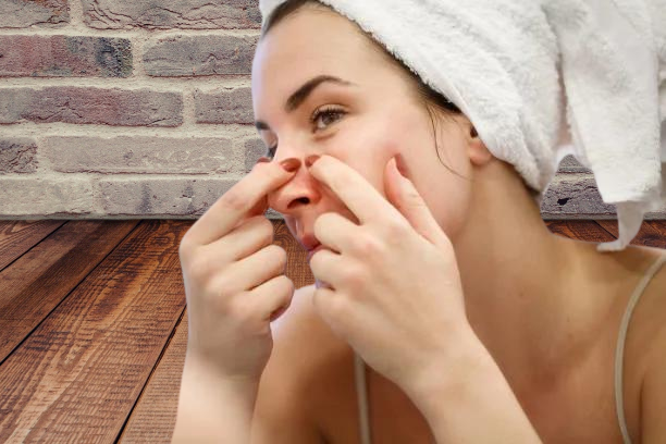 5 easy and quick home recipes to get rid of acne