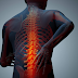 Recognize symptoms of Osteoporosis in early ages