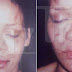 Site divulga foto de Rihanna com o rosto machucado