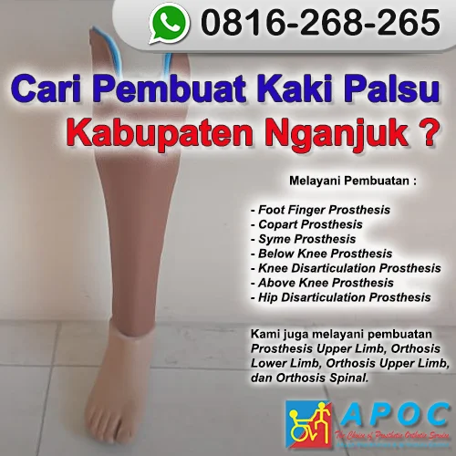 Cari Kaki Palsu Kabupaten Nganjuk >> WA 0816-268-265, Kaki Palsu Besi