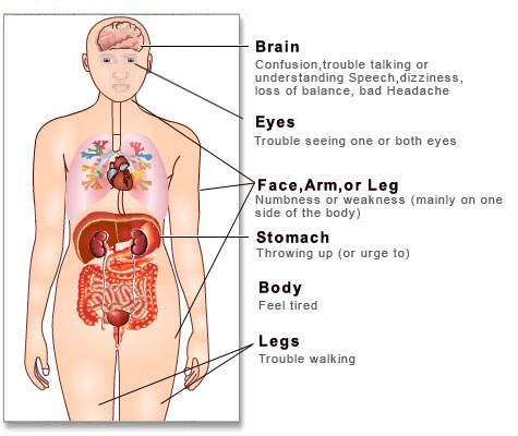 for Primary Stroke Centers