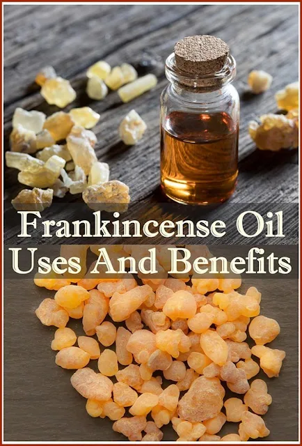 What Is Frankincense Good For? 8 Essential Oil Uses