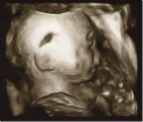 Sonograms 11-22-10(7)