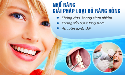 Nhổ răng sâu ở đâu an toàn và không đau nhức?