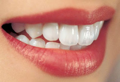 Cách tẩy trắng răng bị ố vàng hiệu quả nhất quả đất-2