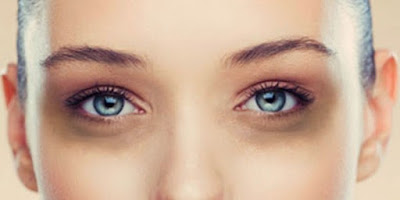 10 Cara Menghilangkan Kantung dan Lingkar Hitam Pada Mata