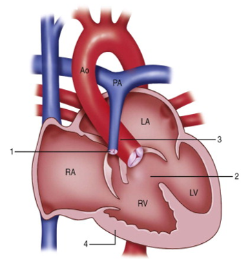 Anatomi Tubuh Black Nurse anatomi jantung 