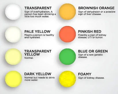 Urine color chart and meaning