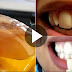 Gargle With One Simple Ingredient And See What Happens To Your Teeth