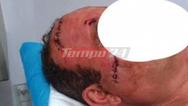 Γιατρός ξυλοκόπησε και χαράκωσε ασθενή στο πρόσωπο με ποτήρι (σκληρές εικόνες)