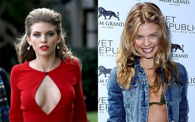 AnnaLynne McCord Before/After Breast Implant Plastic 