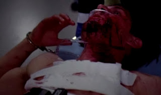 Greys-Anatomy-S10E07-Thriller-Zombie