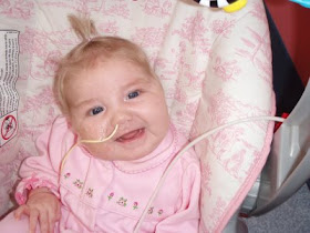 baby mia heart transplant Critical Aortic Stenosis