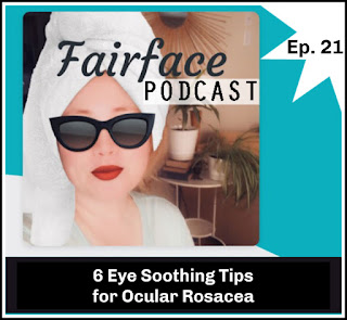 Tips for ocular rosacea Home Remedies and Wearing contacts Fairface Podcast