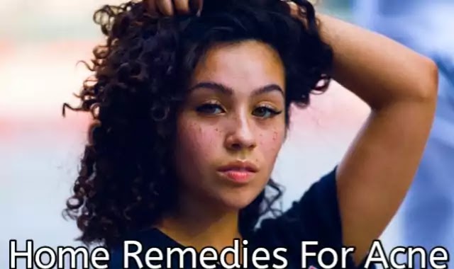Home Remedies For Acne-मुँहासे के लिए 6 घरेलू उपचार