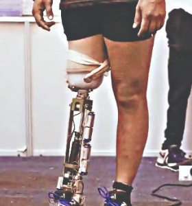 World Record Set in Modern Artificial Limbs (Legs) 