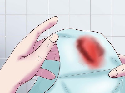 Sảy thai ra máu hơn 15 ngày mẹ cần đi khám