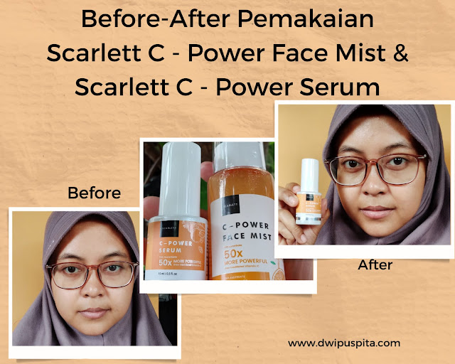 Before after Pakai Scarlett C- Power Serum