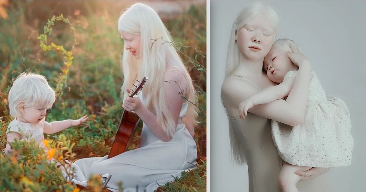 12 Years Apart Albino Sisters Share Mesmerizing Pictures That Exalt The Beauty Of Their Condition