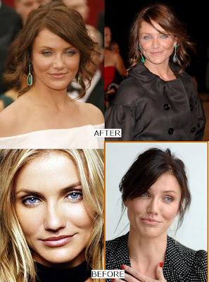 Cameron Diaz Nose Job (Before & After)