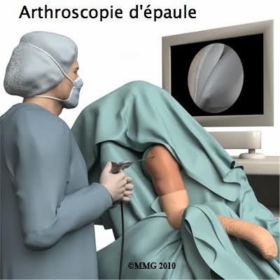 ARTHROSCOPIE