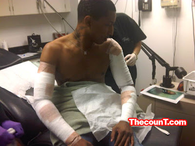 PHARRELL IS TRYING A NEW TATTOO REMOVAL PROCEDURE! PHARRELL IS TRYING A NEW TATTOO REMOVAL PROCEDURE!