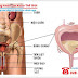 Phương Pháp Chữa Trị Viêm Bàng Quang Hiệu Quả