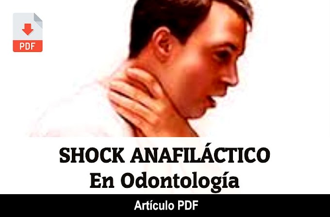 PDF: Shock Anafiláctico en Odontología - Caso Clínico