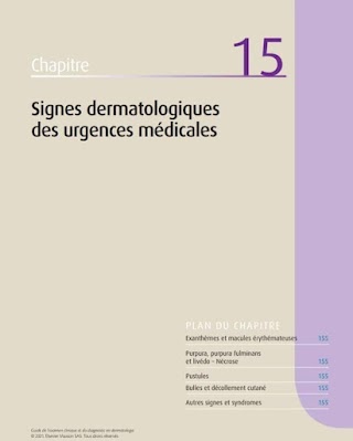 Signes dermatologiques des urgences médicales 2021