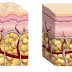 Comment se débarrasser de la cellulite dans les cuisses ?