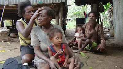 marginalisasi merupakan masalah sosial dan menjadi skandal bagi wilayah yang sangat kaya seperti Papua.