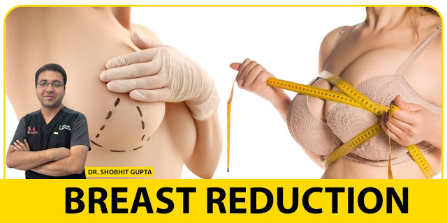 Brеast reduction surgery in Dеlhi