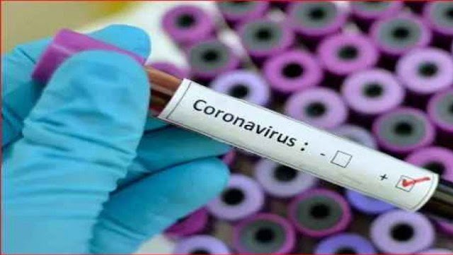 Coronavirus Cases in Pakistan up to 2081