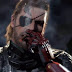 Amputee to get Metal Gear Solid-inspired prosthetic arm