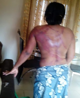  Woman cries out after she was brutally beaten by husband in Port Harcourt