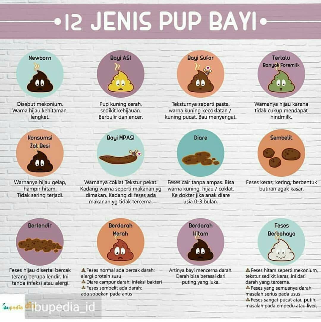 Jenis Jenis Pup Bayi Jenis Jenis Pup Bayi