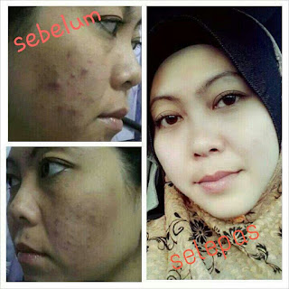 Testimoni Firmax3 Cream