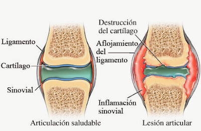 Articulación