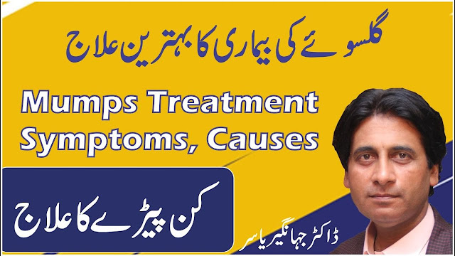 Mumps Treatment in Urdu | kanpere ka ilaj | Mumps causes, symptoms,Treamnent | Dr Jahangir Yasir