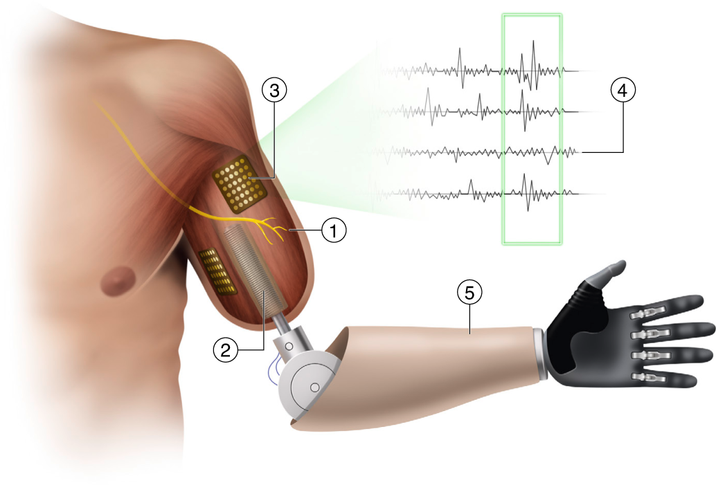 bioadapt_performance_prosthetic