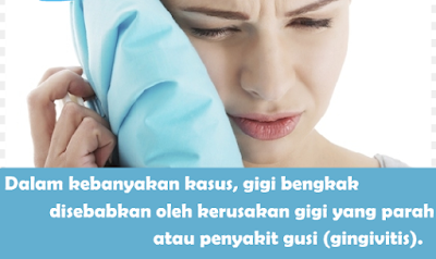 Tips Mengobati Gusi Bengkak Secara Alami Dan Secara Tradisional karena Hamil  Gingivitis , Kurang vitamin B dan C