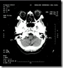 image_thumb5