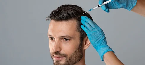 Innovations In Hair Loss Treatments: Exploring Non-Surgical Options